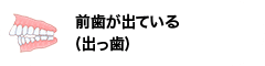 前歯が出ている(出っ歯)