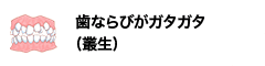 歯ならびがガタガタ(叢生)