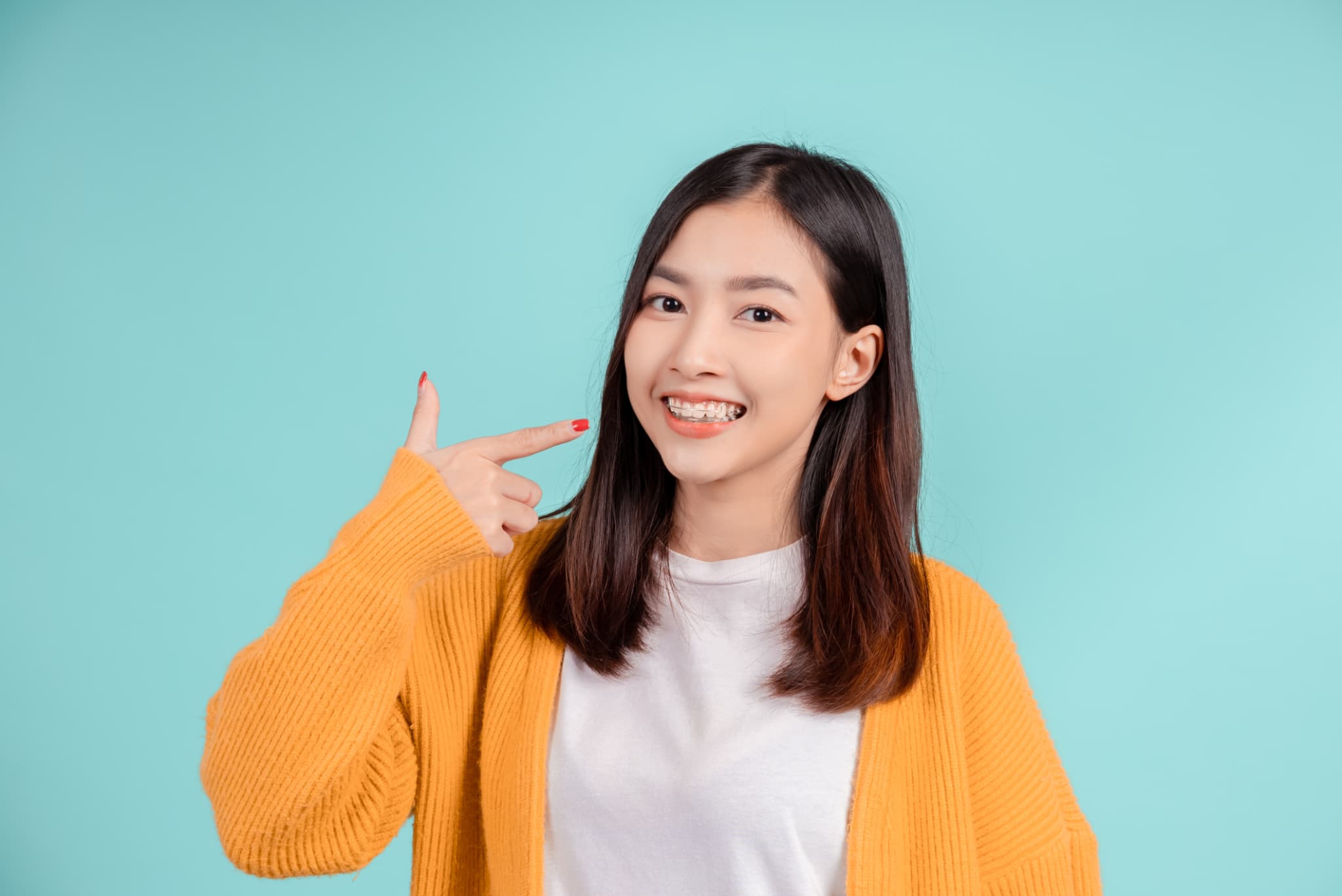 抜歯をしてワイヤー矯正を始めた女性