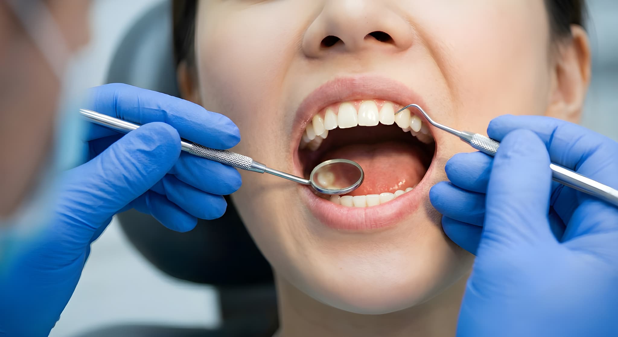 ホワイトニング前にお口の状態を確認する様子
